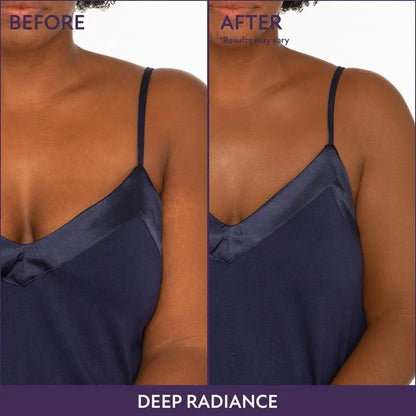 💝 Mother's Day Deal 70% OFF! 💝Lovilds™Body Coverage Perfector