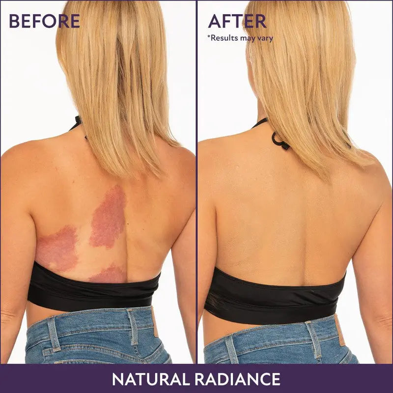 💝 Mother's Day Deal 70% OFF! 💝Lovilds™Body Coverage Perfector