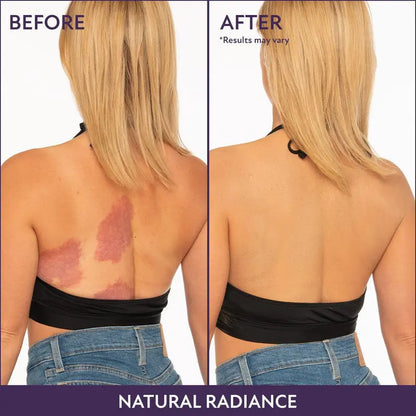 💝 Mother's Day Deal 70% OFF! 💝Lovilds™Body Coverage Perfector
