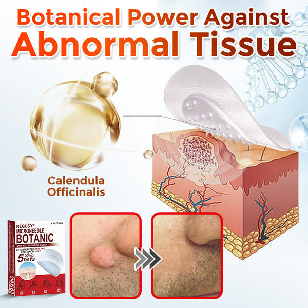Skin Tag & Mole Removal Patches – Buy 1 Get 1 Free