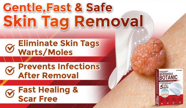 Skin Tag & Mole Removal Patches – Buy 1 Get 1 Free