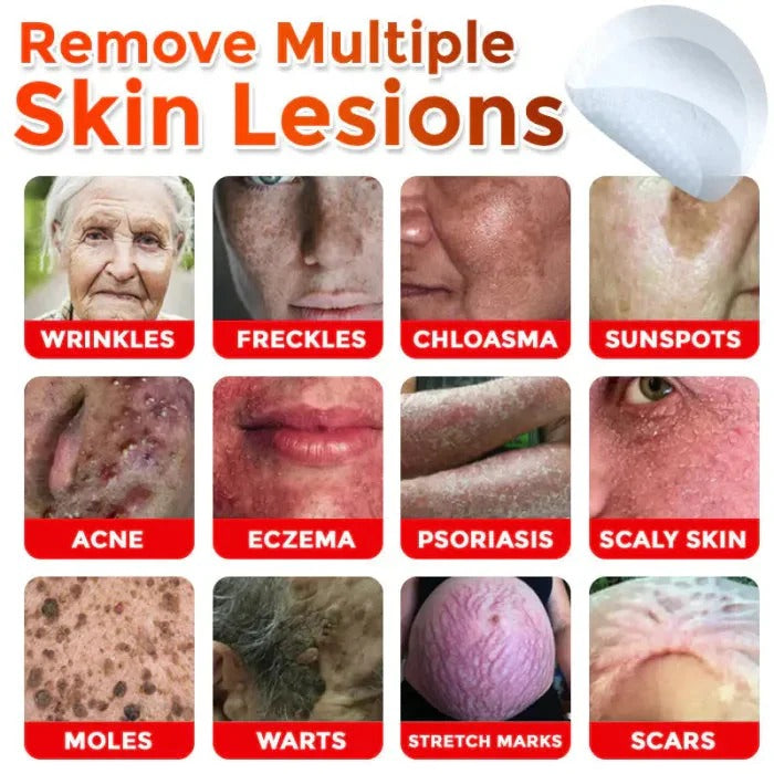 Skin Tag & Mole Removal Patches – Buy 1 Get 1 Free