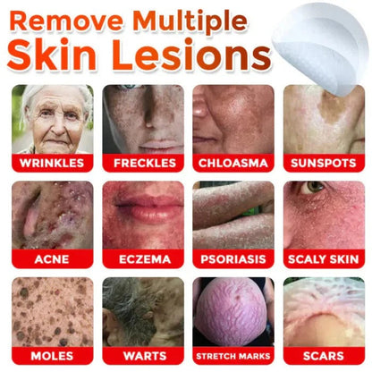 Skin Tag & Mole Removal Patches – Buy 1 Get 1 Free